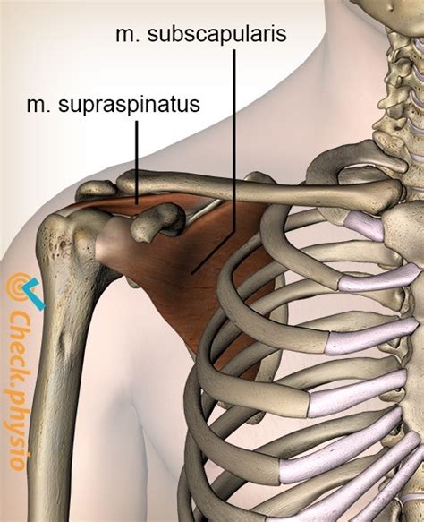 subscapularis tenosynovitis